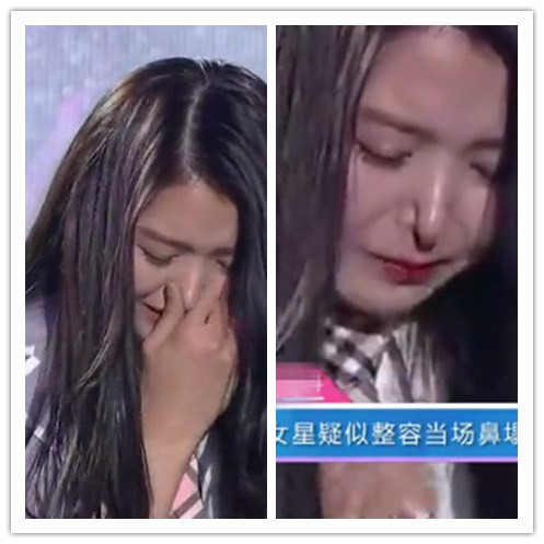 任娜英鼻子塌陷 吃瓜群众表示受到了惊吓! 任娜英鼻子塌陷 吃瓜群众表示受到了惊吓!